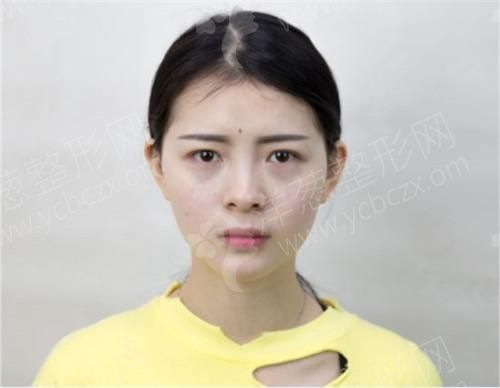术前(51).jpg