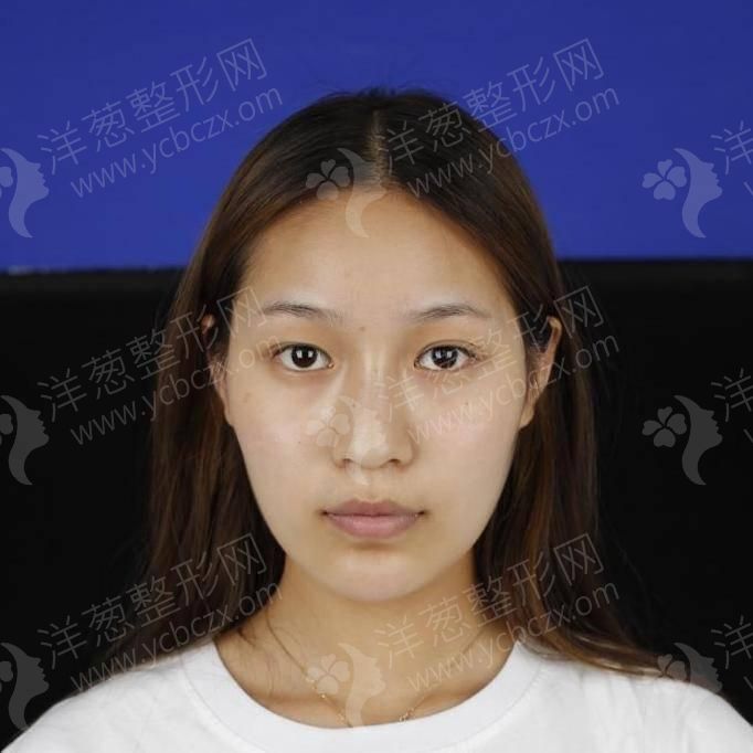 039077e34feff52723576708d168b288_a52e0d48727149ad8cd0d650e0229eac-o.jpg