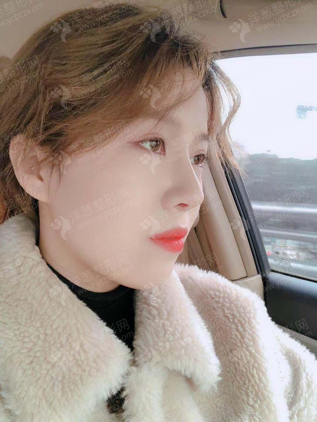术后.jpg
