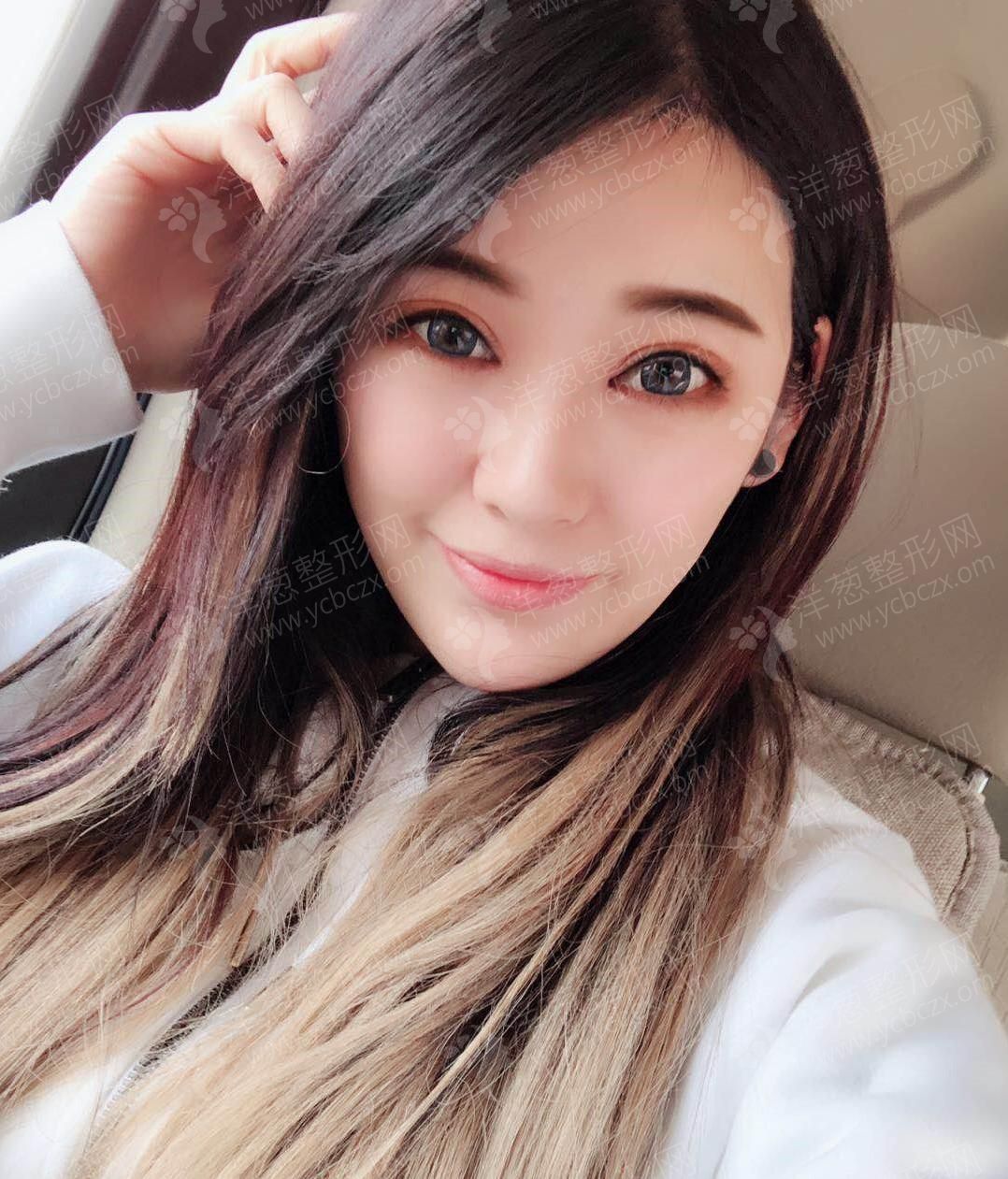 术中.jpg