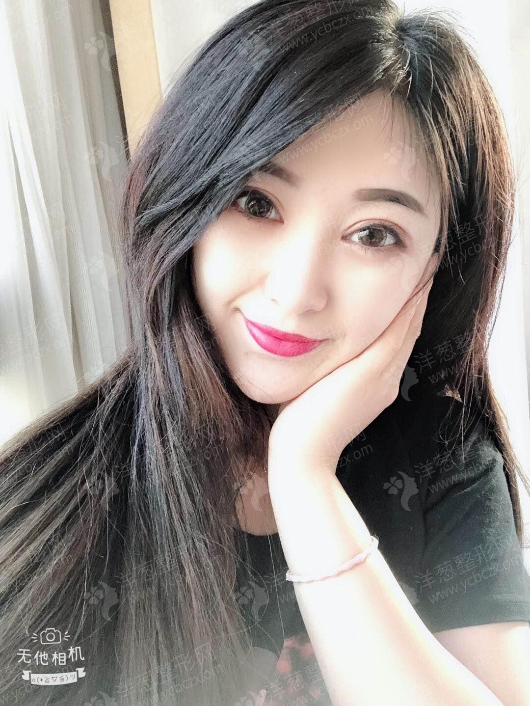 术后.jpg