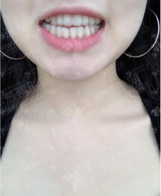1629256614571125.png image.png