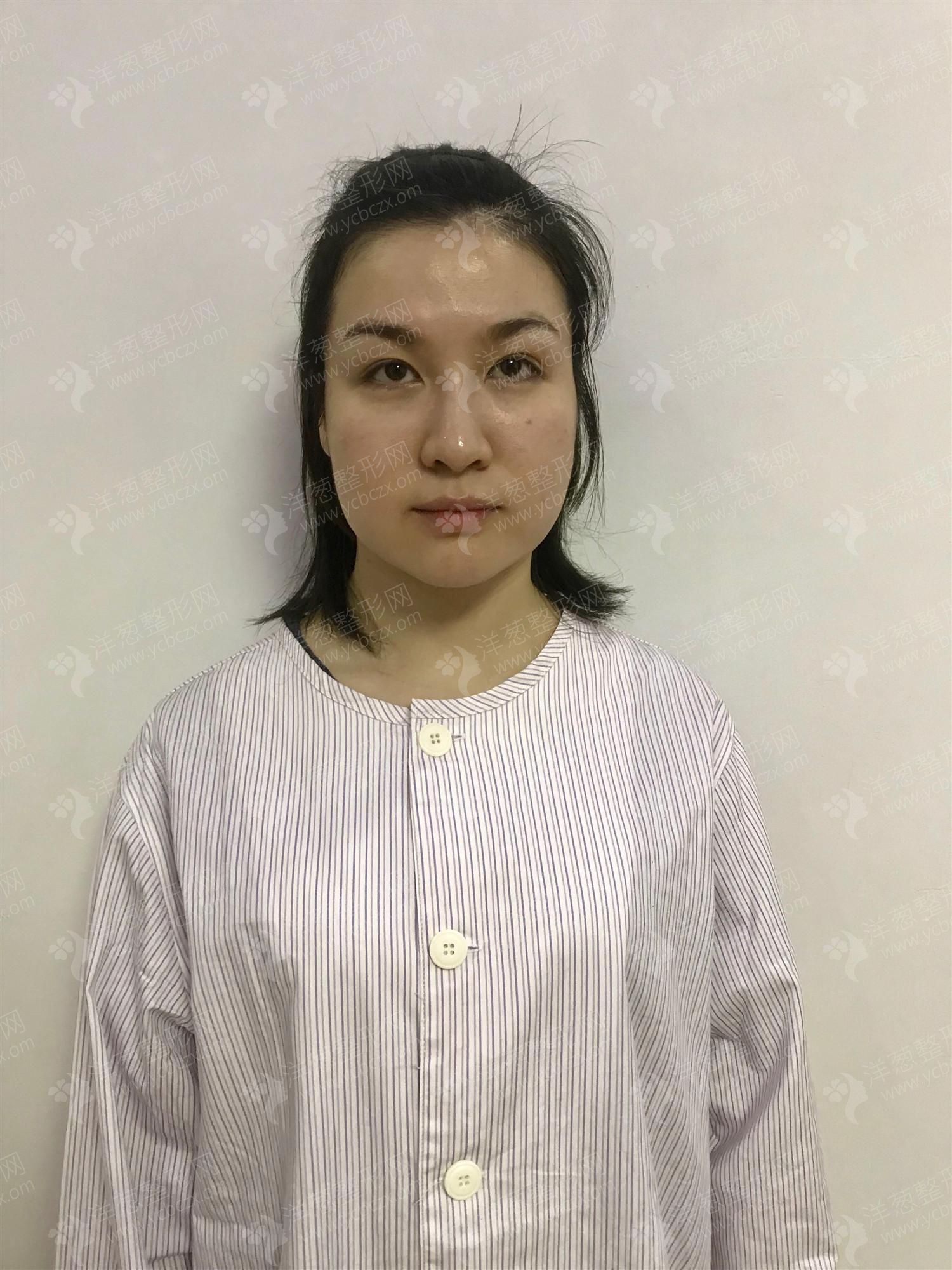 术前.jpg