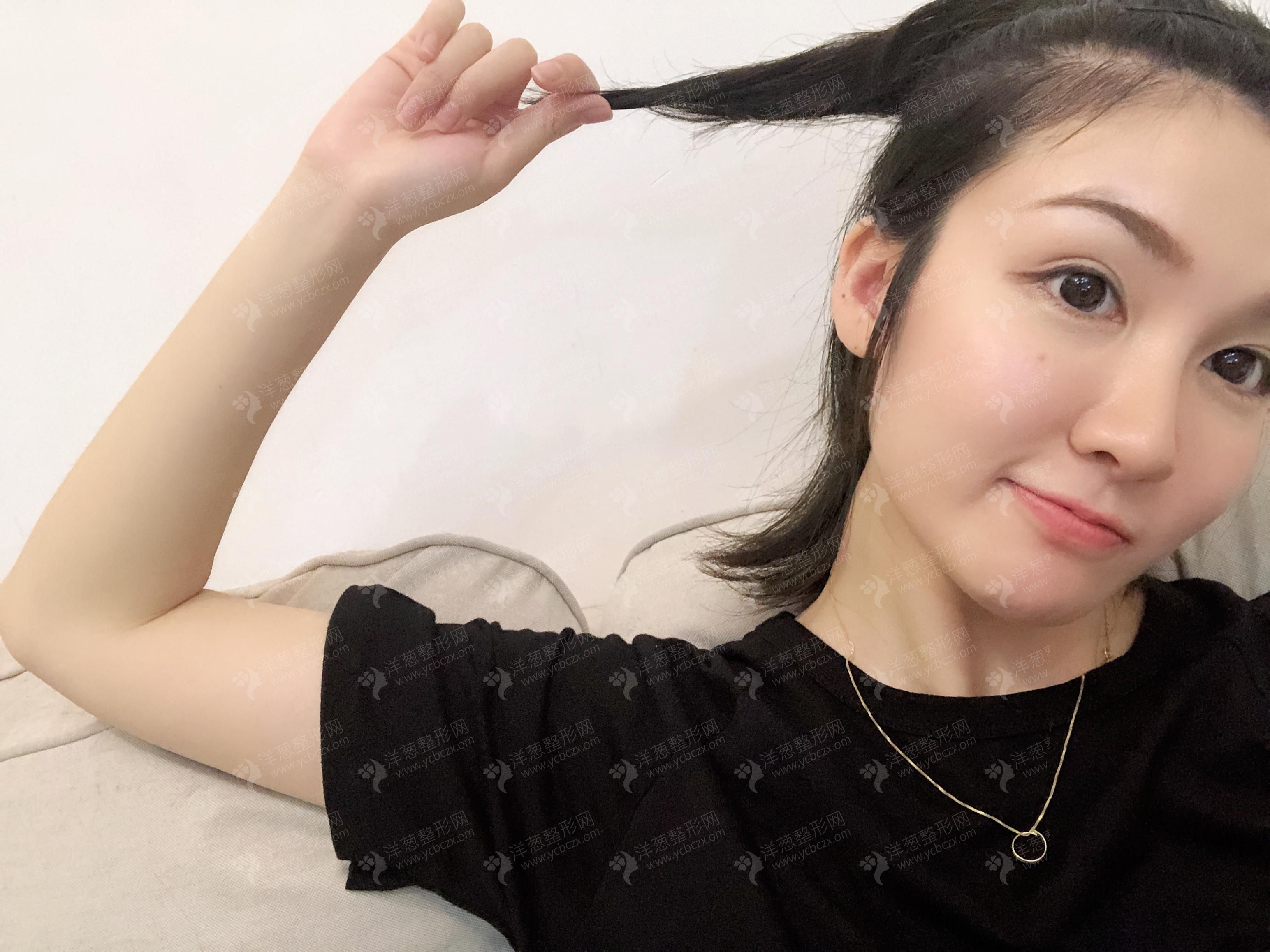 术后.jpg