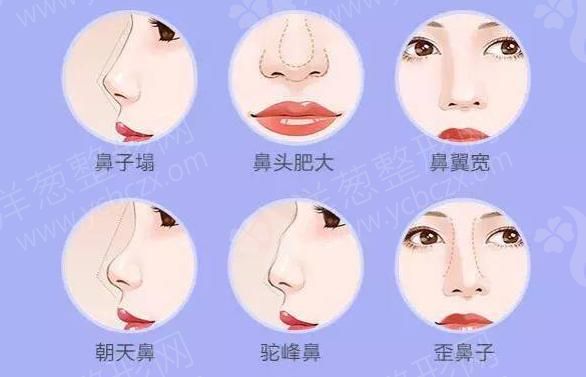 1631951274347288.png QQ浏览器截图20210908165834.png
