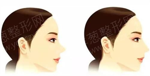 1687593282432743.jpg 隆鼻33.jpg